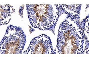 Detection of CASP8 in Mouse Testis Tissue using Polyclonal Antibody to Caspase 8 (CASP8) (Caspase 8 antibody  (AA 219-376))