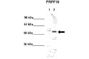 WB Suggested Anti-PRPF19 Antibody    Positive Control:  Lane 1: 5ug mouse brain cytoplasm Lane 2: 5ug mouse brain nucleus   Primary Antibody Dilution :   1:1000  Secondary Antibody :  Anti rabbit - IR-dye  Secondry Antibody Dilution :   1:10,000   Submitted by:  Anonymous