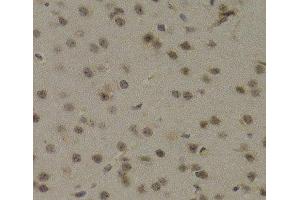 Immunohistochemistry of paraffin-embedded Mouse brain using PAWR Polyclonal Antibody at dilution of 1:200 (40x lens). (PAWR antibody)
