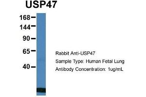 Host: Rabbit  Target Name: USP47  Sample Tissue: Human Fetal Lung  Antibody Dilution: 1. (USP47 antibody  (Middle Region))
