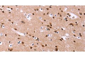 Immunohistochemistry (Paraffin-embedded Sections) (IHC (p)) image for anti-Inhibitor of DNA Binding 4, Dominant Negative Helix-Loop-Helix Protein (ID4) antibody (ABIN7243412)