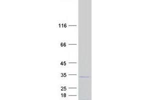 Validation with Western Blot