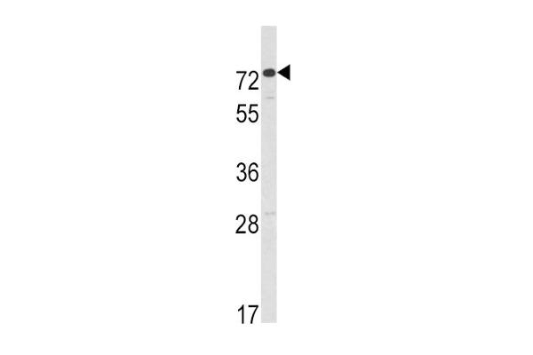 AMHR2 antibody  (C-Term)