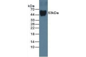 Detection of DBP in Rat Serum using Monoclonal Antibody to Vitamin D Binding Protein (DBP) (Vitamin D-Binding Protein antibody  (AA 209-394))