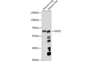 Western blot analysis of extracts of various cell lines, using SNTB1 antibody (ABIN7270693) at 1:1000 dilution. (SNTB1 antibody  (AA 1-110))