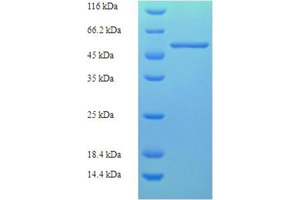 Fasciclin Arabinogalactan Protein 1 (FLA1) (AA 1-336), (full length) protein (His-SUMO Tag)