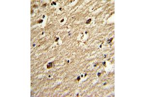 Formalin-fixed and paraffin-embedded human brain tissue reacted with the primary antibody, which was peroxidase-conjugated to the secondary antibody, followed by DAB staining. (PIAS4 antibody  (C-Term))