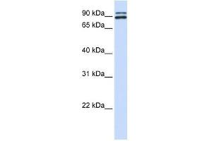PCSK6 antibody used at 0. (PCSK6 antibody  (N-Term))