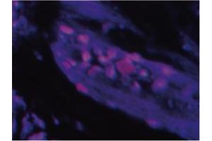 Immunofluorescence image ofTlP 39 staining in paraffn section of human trachea. (Parathyroid Hormone 2 (PTH2) antibody)