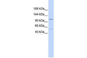 PCDH8 antibody used at 1 ug/ml to detect target protein. (Protocadherin 8 antibody  (Middle Region))