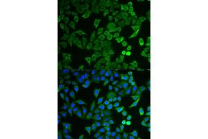 Immunofluorescence analysis of HeLa cells using NPRL2 antibody (ABIN6132809, ABIN6144787, ABIN6144788 and ABIN6221564).