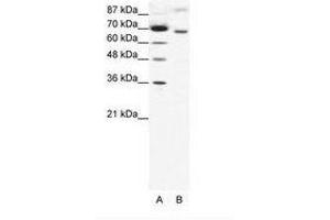 Image no. 1 for anti-Rac GTPase Activating Protein 1 (RACGAP1) (AA 20-69) antibody (ABIN202842) (RACGAP1 antibody  (AA 20-69))