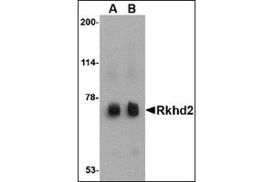 Western blot analysis of Rkhd2 in rat heart tissue lysate with this product at (A) 0.
