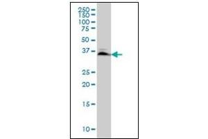 Western Blotting (WB) image for anti-SMAD, Mothers Against DPP Homolog 3 (SMAD3) antibody (ABIN781908) (SMAD3 antibody)