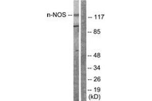Western blot analysis of extracts from Raw264. (NOS1 antibody  (AA 818-867))