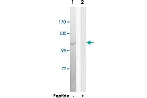 Western blot analysis of extracts from K-562 cells, using POLD1 polyclonal antibody . (POLD1 antibody)