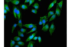 Immunofluorescent analysis of Hela cells using ABIN7150926 at dilution of 1:100 and Alexa Fluor 488-congugated AffiniPure Goat Anti-Rabbit IgG(H+L) (Dystonin antibody  (AA 1-195))