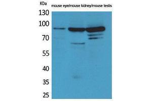 Western Blotting (WB) image for anti-HRS (HRS) (Internal Region) antibody (ABIN3180991) (HRS (HRS) (Internal Region) antibody)