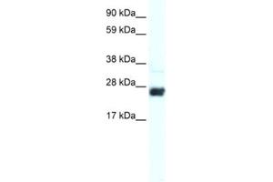 Western Blotting (WB) image for anti-Caudal Type Homeobox 2 (CDX2) antibody (ABIN2460232) (CDX2 antibody)