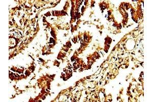 IHC image of ABIN7142886 diluted at 1:250 and staining in paraffin-embedded human lung tissue performed on a Leica BondTM system.