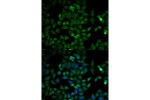 Immunofluorescence analysis of HeLa cells using TPI1 antibody. (TPI1 antibody)