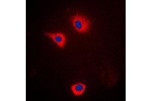 Immunofluorescent analysis of Cytochrome P450 2U1 staining in LOVO cells. (CYP2U1 antibody  (Center))