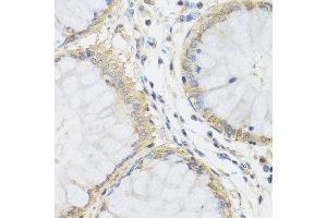 Immunohistochemistry of paraffin-embedded human colon using MTX1 antibody at dilution of 1:100 (x40 lens). (Metaxin 1 antibody)