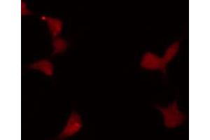 ABIN6272240 staining LOVO by IF/ICC. (MYBL1 antibody  (Internal Region))