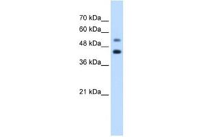 GTPBP2 antibody used at 1. (GTPBP2 antibody  (C-Term))