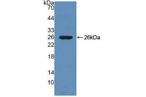 Detection of Recombinant DNM1, Mouse using Polyclonal Antibody to Dynamin 1 (DNM1) (Dynamin 1 antibody  (AA 572-745))