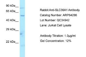 Western Blotting (WB) image for anti-Solute Carrier Family 36 (Proton/amino Acid Symporter), Member 1 (SLC36A1) (N-Term) antibody (ABIN2789790) (SLC36A1 antibody  (N-Term))