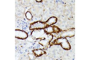 Immunohistochemistry of paraffin-embedded rat kidney using MT-ND5 antibody (ABIN7268603) at dilution of 1:100 (40x lens). (MT-ND5 antibody  (C-Term))