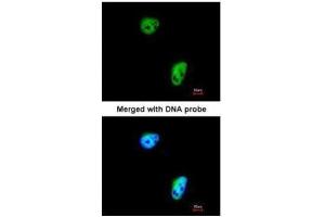 ICC/IF Image Immunofluorescence analysis of paraformaldehyde-fixed HeLa, using TLK1, antibody at 1:200 dilution. (TLK1 antibody)