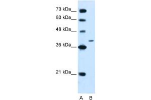 WB Suggested Anti-PTPN2 Antibody Titration:  2. (PTPN2 antibody  (N-Term))