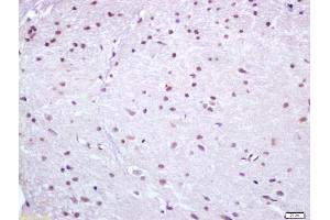 Formalin-fixed and paraffin embedded rat brain labeled with Anti Nur77 Polyclonal Antibody (ABIN747443), Unconjugated at 1:200, followed by conjugation to the secondary antibody and DAB staining (NR4A1 antibody  (AA 351-450))