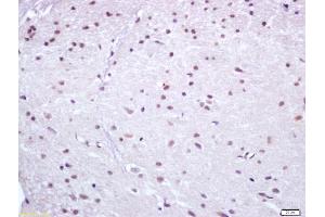 Immunohistochemistry (IHC) image for anti-Nuclear Receptor Subfamily 4, Group A, Member 1 (NR4A1) (AA 351-450) antibody (ABIN747443)