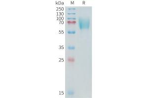 Cynomolgus B7-H3 Protein, His Tag on SDS-PAGE under reducing condition.