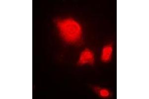 Immunofluorescent analysis of UCH-L5 staining in A549 cells. (UCHL5 antibody)