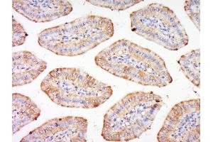 Paraformaldehyde-fixed, paraffin embedded mouse intestine, Antigen retrieval by boiling in sodium citrate buffer (pH6) for 15min, Block endogenous peroxidase by 3% hydrogen peroxide for 30 minutes, Blocking buffer (normal goat serum) at 37°C for 20min, Antibody incubation with Integrin alpha 3 Polyclonal Antibody, Unconjugated  at 1:200 overnight at 4°C, followed by a conjugated secondary and DAB staining. (ITGA3 antibody  (AA 976-1025))