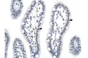 HNRPA1 antibody was used for immunohistochemistry at a concentration of 4-8 ug/ml to stain Epithelial cells of intestinal villus (arrows) in Human Intestine . (HNRNPA1 antibody  (C-Term))