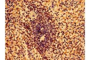 Immunohistochemistry (IHC) image for anti-Major Histocompatibility Complex, Class I, B (HLA-B) (AA 197-306) antibody (ABIN7155563)