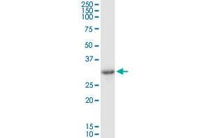 SULT1B1 MaxPab rabbit polyclonal antibody. (SULT1B1 antibody  (AA 1-296))