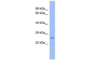 PSMB6 antibody used at 1 ug/ml to detect target protein. (PSMB6 antibody)