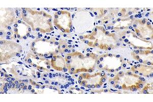 Immunohistochemistry (IHC) image for anti-Apoptosis-Inducing Factor, Mitochondrion-Associated, 1 (AIFM1) (AA 103-322) antibody (ABIN7433090)