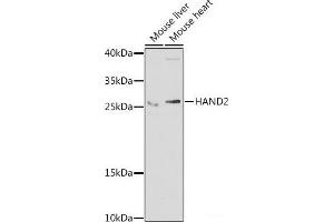 Western blot analysis of extracts of various cell lines using HAND2 Polyclonal Antibody at dilution of 1:1000. (HAND2 antibody)
