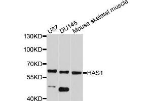 Western blot analysis of extracts of various cell lines, using HAS1 antibody (ABIN5997874) at 1/1000 dilution. (HAS1 antibody)