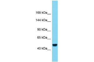 Host:  Rabbit  Target Name:  RBL2  Sample Type:  Liver Tumor lysates  Antibody Dilution:  1. (p130 antibody  (C-Term))