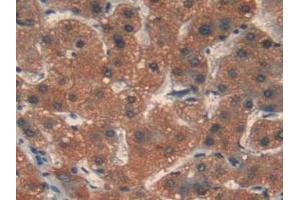 Figure. (MMP12 antibody  (AA 290-469))