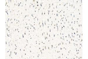 ABIN7094868 and ABIN7098920 at 1/100 staining Rat heart tissue by IHC-P. (UBASH3B antibody  (Internal Region))
