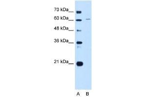 CDT1 antibody used at 1 ug/ml to detect target protein. (CDT1 antibody  (C-Term))